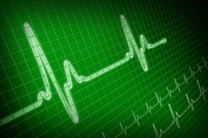 arrhythmias-1